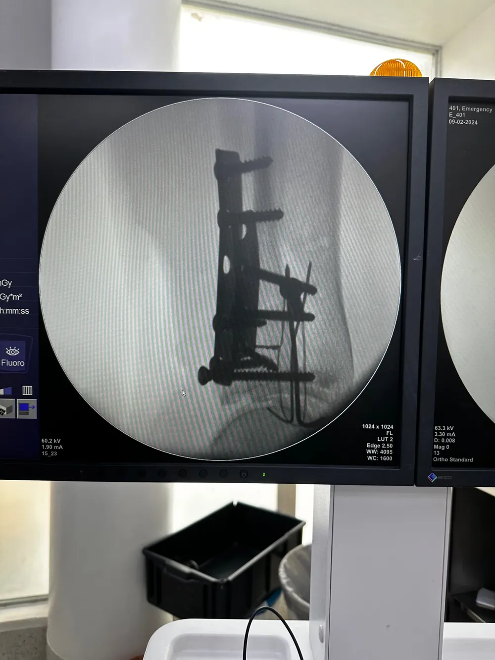 Exame de imagem ortopédico